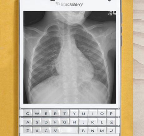 %name BlackBerry reveals the Passport’s killer feature: The ability to look at x rays of your lung by Authcom, Nova Scotia\s Internet and Computing Solutions Provider in Kentville, Annapolis Valley